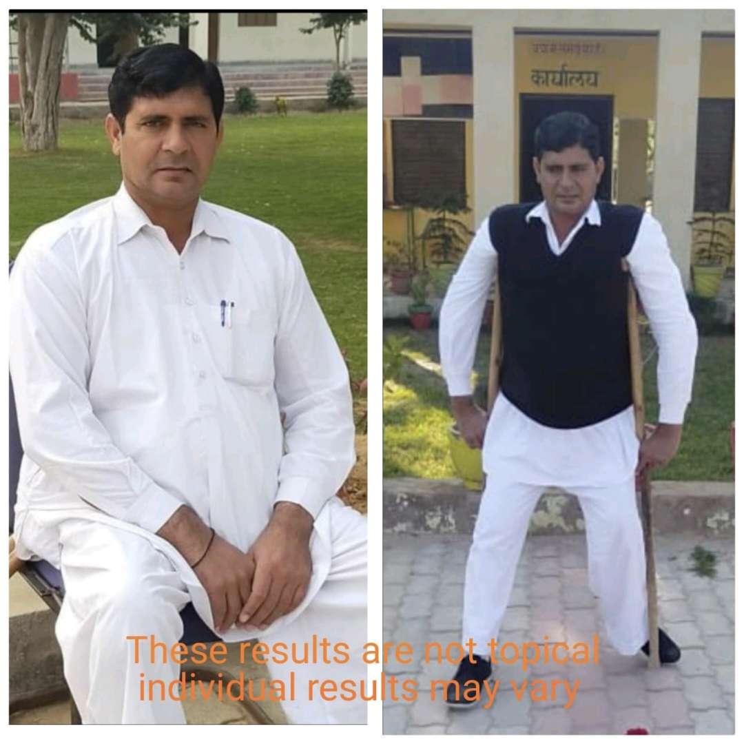 Dilip Kumar before and after transformation result
